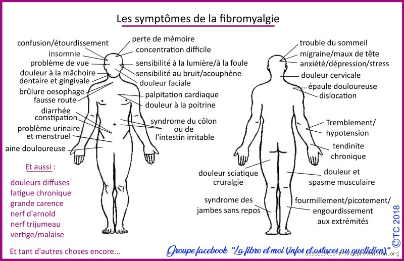 Qu'est-ce que la fibromyalgie ? Comprendre cette maladie chronique et mystérieuse