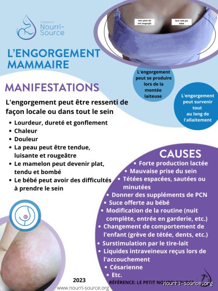 Comment arrêter l'allaitement engorgement ?