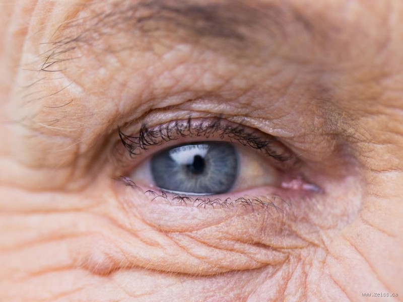 Comment empêcher le vieillissement des yeux ? Protégez votre vue dès maintenant