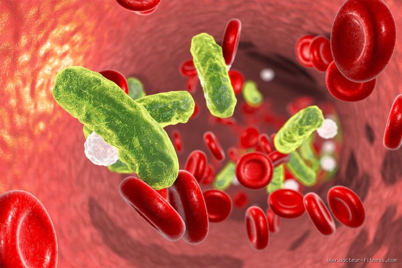 Comment savoir si on a une infection dans le sang ?