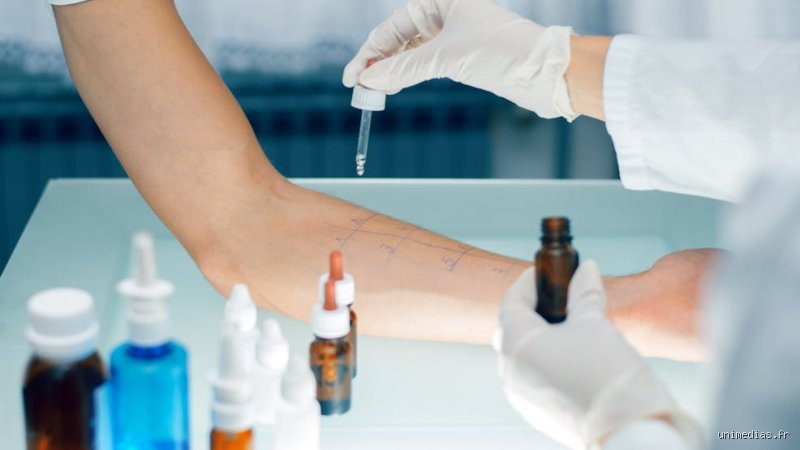 Comment savoir si on est allergique prise de sang ?