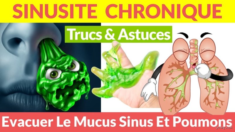 Comment se débarrasser du mucus dans le nez ?