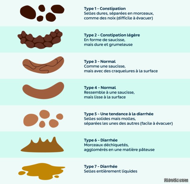 Comment sont les selles en cas de côlon irritable ?