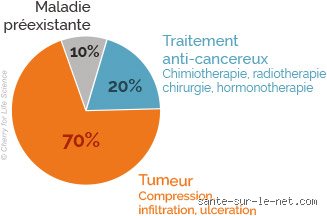 Est-ce qu'on a mal quand on a le cancer ?