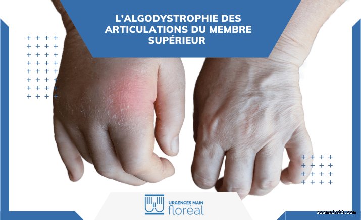 Est-ce que l'algodystrophie peut se propager ?