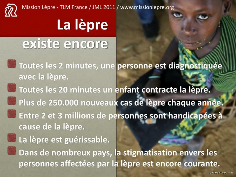Est-ce que la lèpre existe encore en France ?