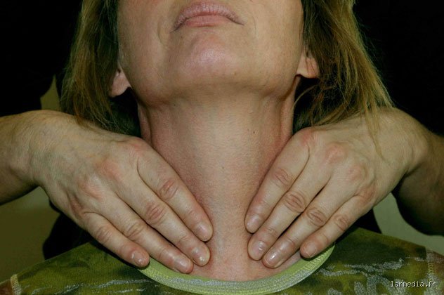 Thyroïde et Tension Artérielle : Le Couple Infernal ? Ce Que Vous Ignorez...