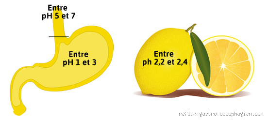 Est-ce que le citron est bon pour une gastrite ? Découvrez la vérité