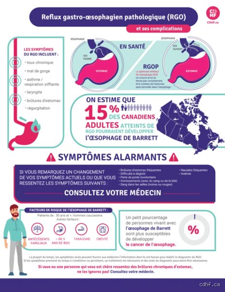 Est-ce que le RGO se guérit ? Guide complet sur la rémission du reflux gastrique