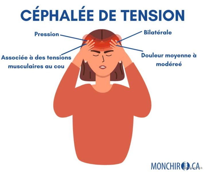 Où se situe le mal de tête stress ?