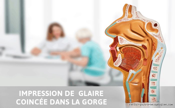 Pourquoi j'ai l'impression que j'ai un truc dans la gorge ?