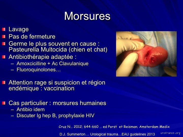 Pourquoi la verge se déforme ?