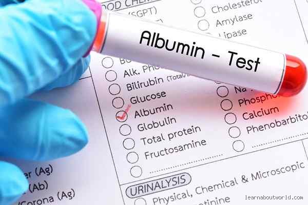 Pourquoi surveiller l'albumine ?