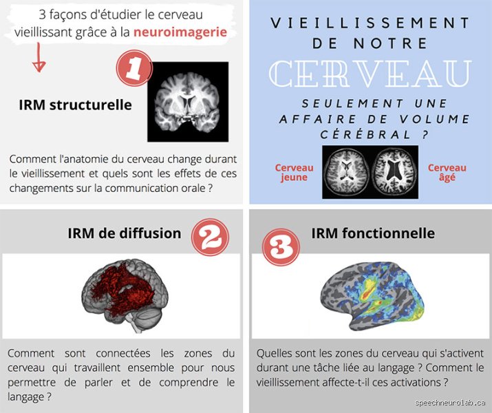 Qu'est-ce qui fait vieillir le cerveau ?