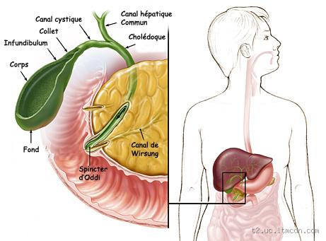 Qu'est-ce qui peut provoquer une inflammation de la vésicule biliaire ?