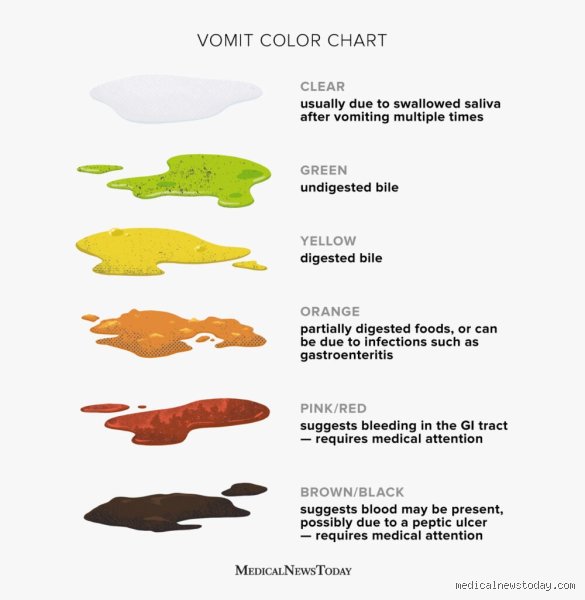 Quand on vomit, qu'est-ce qui sort en premier ?