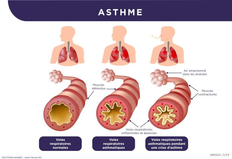 Quel est le microbe responsable de l'asthme ?