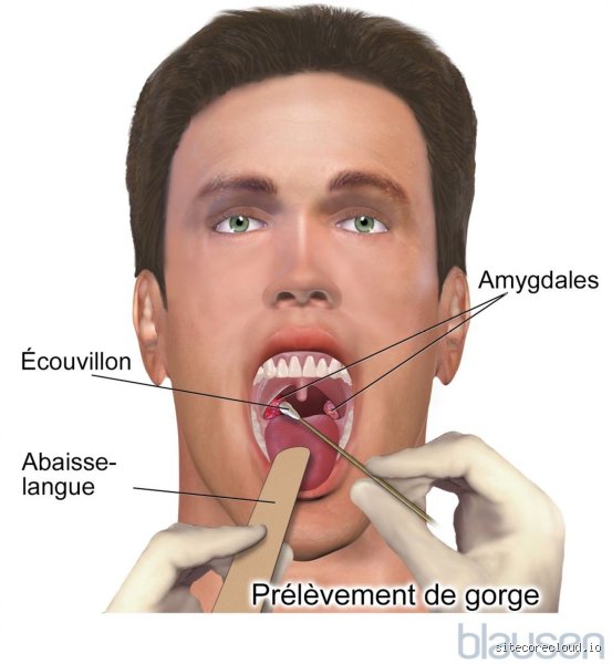 Quel examen pour voir dans la gorge quand ça ne va pas ? Le guide sans jargon