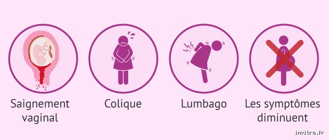 Quelle infection peut provoquer une fausse couche ?