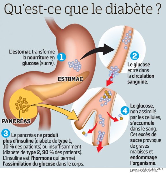 Quel est le lien réel entre votre pancréas et le diabète ?