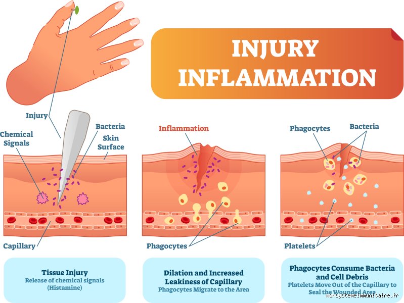 Quelle est la différence entre inflammé et enflammé ? Le guide ultime pour ne plus jamais confondre ces deux termes médicaux et littéraires