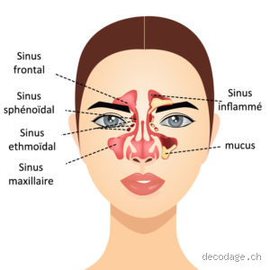 Quelle est la différence entre la rhinite et la sinusite ?