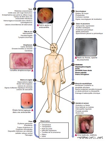 Quelles sont les maladies causées par une infection ? Un voyage au cœur de la guerre invisible entre l'humain et le pathogène