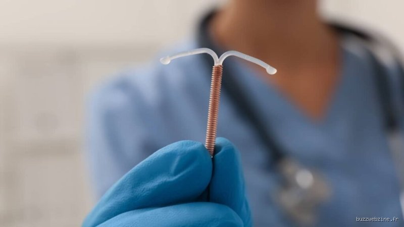Quels sont les réels avantages et inconvénients du stérilet ? Une discussion sans filtre