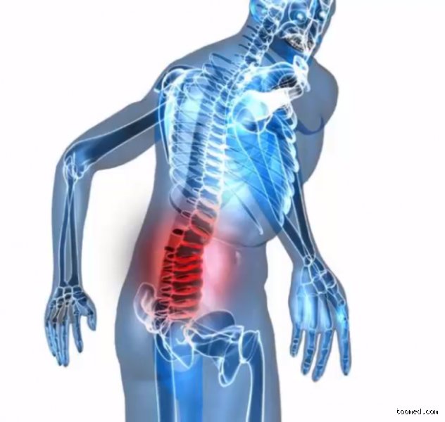 Quels sont les maladie du dos ? Comprendre les pathologies rachidiennes