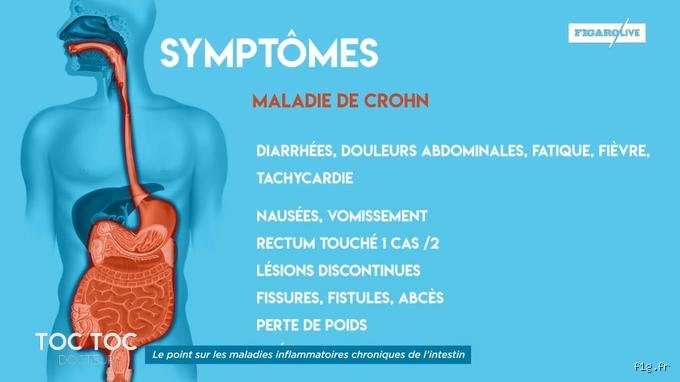 Quels sont les premiers symptômes de la maladie de Crohn ?