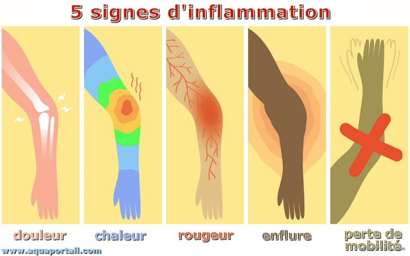 Quels sont les quatre principaux signes de l'inflammation ?