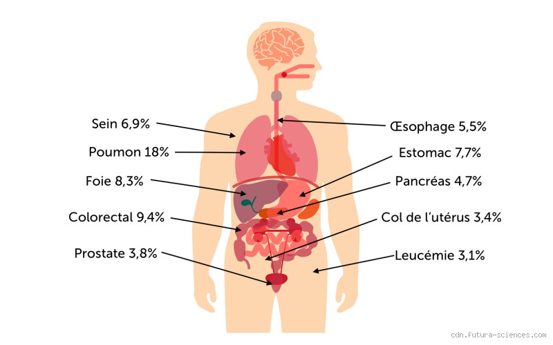 Quels sont les trois cancers les plus mortels ? Ce que personne n’ose te dire