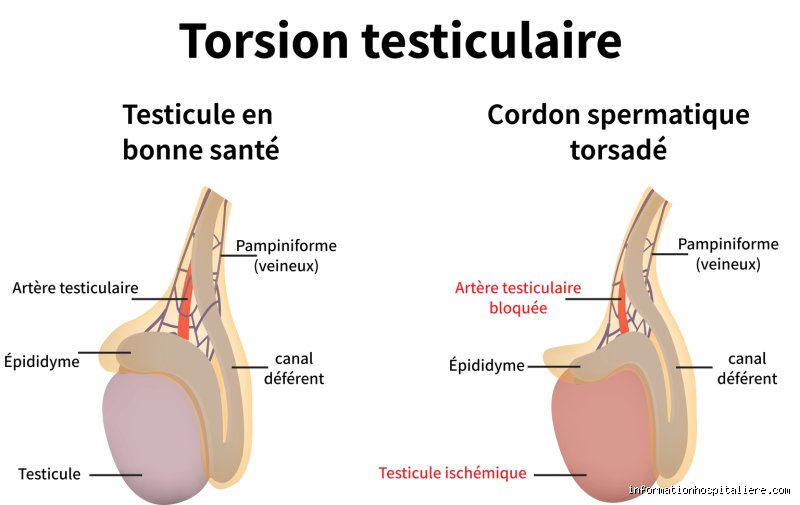 Qui consulter pour une douleur aux testicules ?