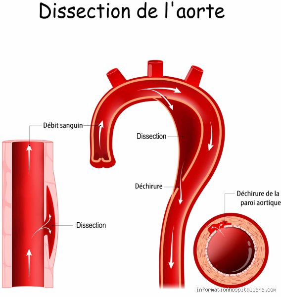Qui provoque l'écœurement ?