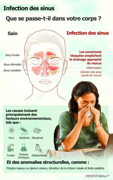 Une carence en vitamine C peut-elle causer des problèmes de sinus ? Enquête sur un lien biologique méconnu