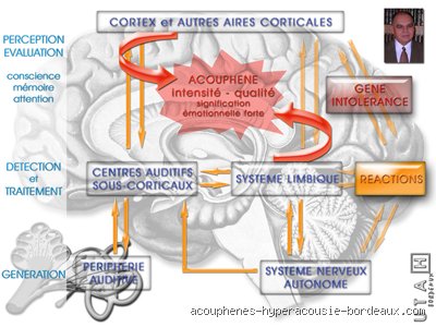 Comment le cerveau s'habitue aux acouphènes : mécanismes et stratégies