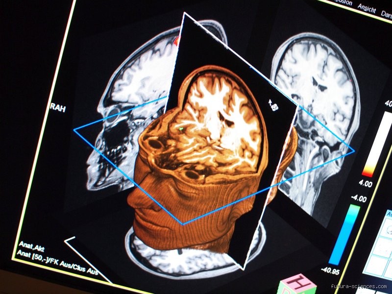 Comment reprogrammer son cerveau pour arrêter de fumer ?