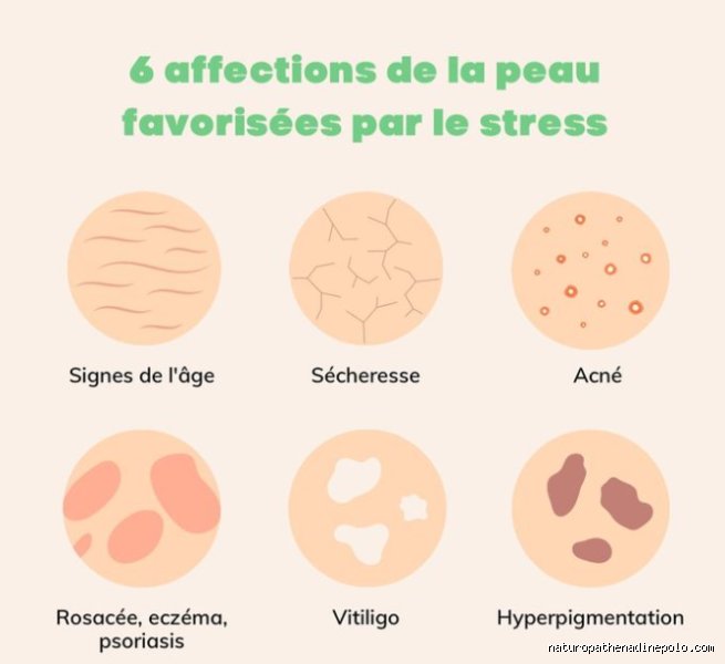 Où sont les boutons de stress ? La vérité sur ces fameux déclencheurs internes