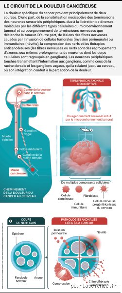 Pourquoi le cancer est-il si douloureux à la fin ? Comprendre la mécanique complexe des souffrances ultimes