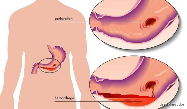 Quel traumatisme est stocké dans l'estomac ? Quand vos tripes hurlent ce que votre bouche a oublié