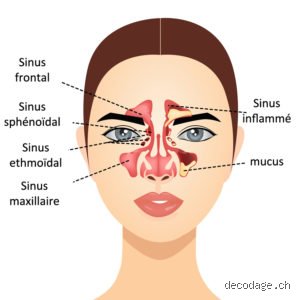Quelle émotion est liée aux sinus ? Ce que votre nez raconte de votre stress