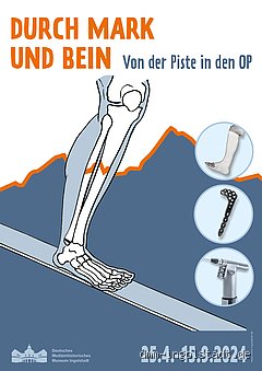 Was bedeutet durch Mark und Bein gehen?