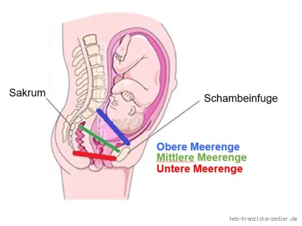 Was bedeutet es, wenn der Kopf fest im Becken sitzt?