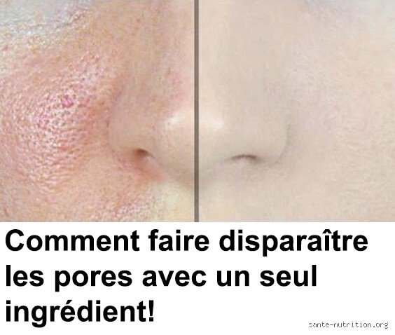 Comment Décrasser ses Pores ?