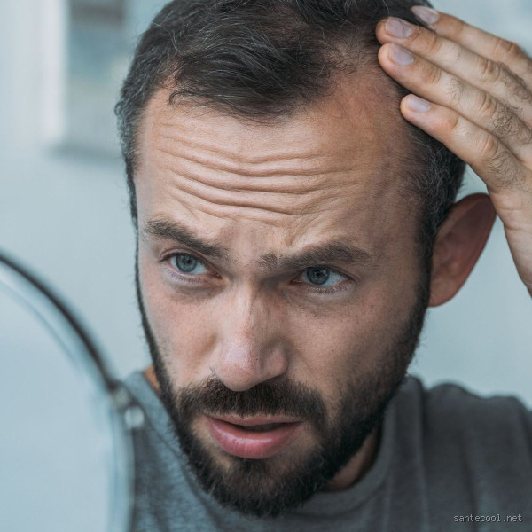 Comment être sûr d'avoir la calvitie ? Découvrez les signes qui ne trompent pas