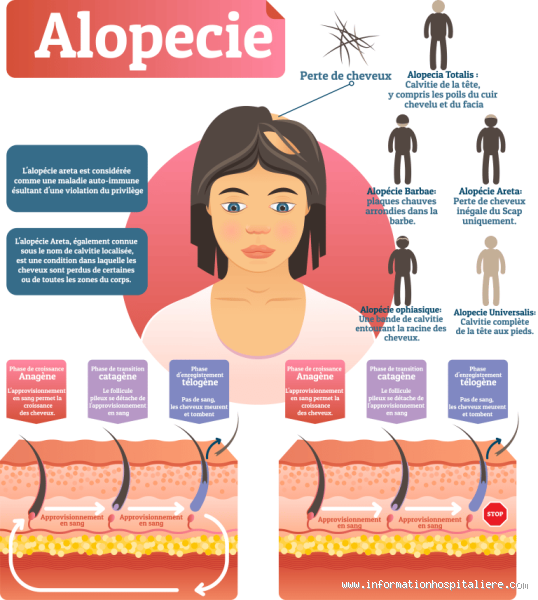 Quelle est la cause des chutes de cheveux ? Ce que personne ne vous dit