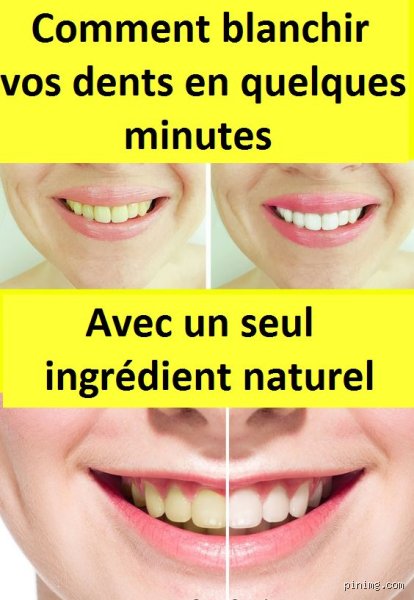 Comment blanchir ses dents immédiatement : méthodes pratiques et efficaces