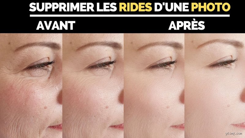 Comment effacer les rides rapidement ?