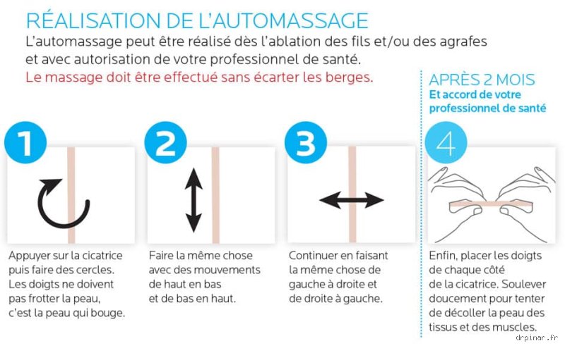 Comment masser une cicatrice Avène ?