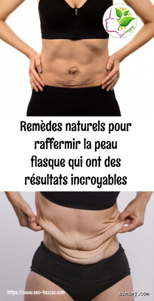 Comment raffermir la peau flasque ?